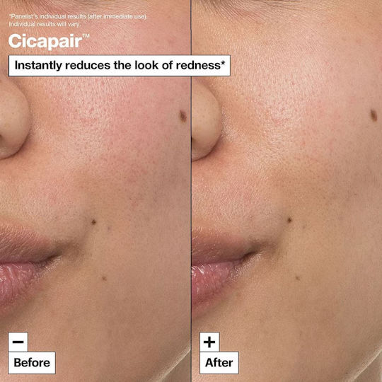 Dr. Jart+ Cicapair Intesive Ενυδατική Κρέμα Προσώπου κατά της Ερυθρότητας με Νιασιναμίδη & Centella Asiatica 50ml Dr. Jart+ Cicapair Intesive Ενυδατική Κρέμα Προσώπου κατά της Ερυθρότητας με Νιασιναμίδη & Centella Asiatica 50ml